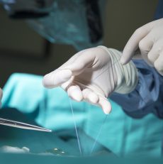 Co trzeba wiedzieć o szwach chirurgicznych?